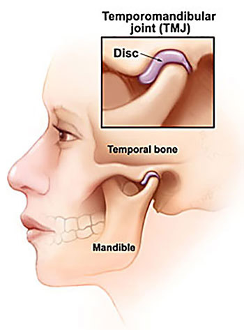 Facial profile illustration showing the temporomandibular joint (TMJ)